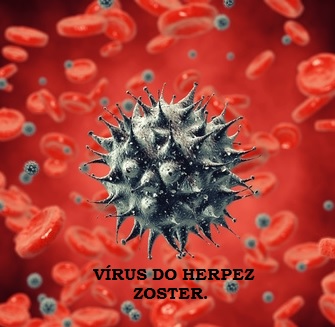 Virus Herpes Zoster